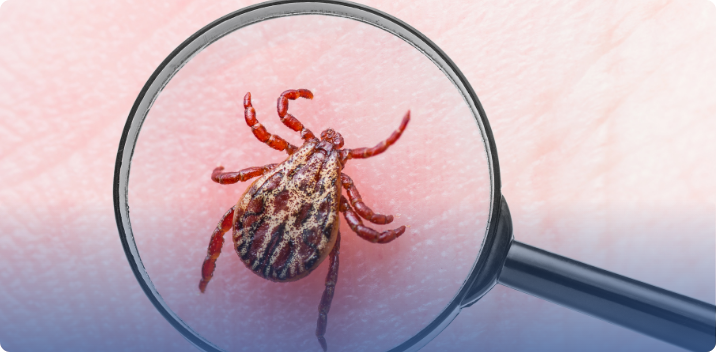 A Practical Evaluation for Lingering Lyme Disease Symptoms in The Woodlands, TX