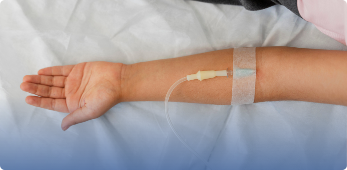 IV Ozone Therapy Explained: Potential Uses, Safety Questions, and Common Myths