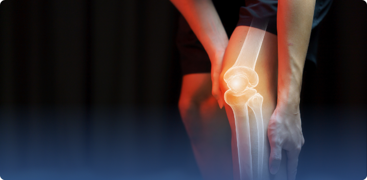 Knee Pain: Arthritis or Injury? How to Tell the Difference