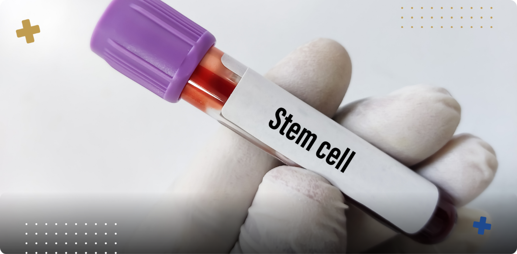 What to Know About Stem Cells as a Nonsurgical Treatment Option
